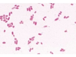 Escherichia coli  Darmbakterien  Ausstrich