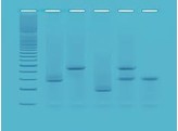 DNA-FINGERPRINTING MIT PCR