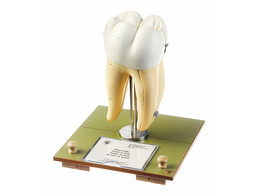 RIGHT LOWER FIRST MOLAR