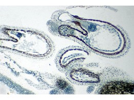 Hirtentaschel  Fruchtknoten mit Embryo in cotyledon St. l.s. - SB.2222A