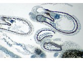 Shephards purse  ovary embryo in cotyledon stadium  l.s. - SB.2222A