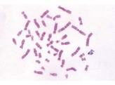 HUMAN CHROMOSOMES IN SMEAR FROM CULTURE OF BLOOD  MALE OR FEMALE