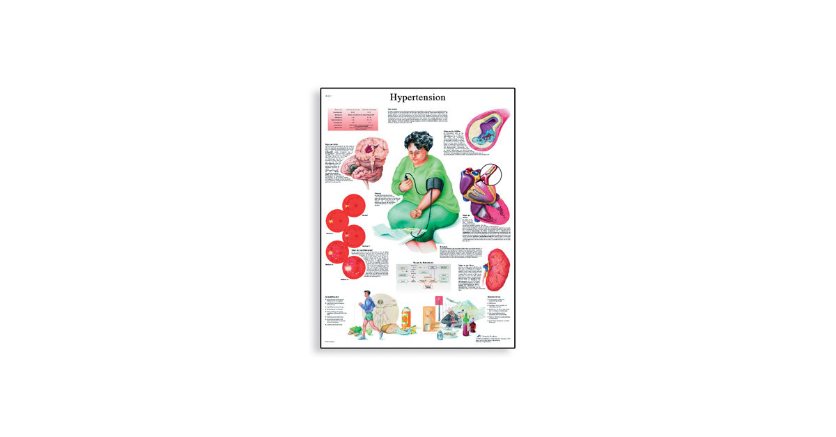 Hypertension Chart Vr L Leermiddelen