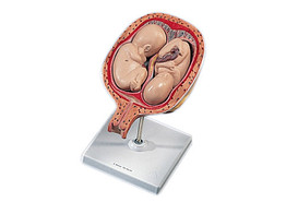 5TH MONTH TWIN FETUSES - NORMAL POSITION L10/7  1000328 