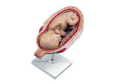 5TH MONTH TWIN FETUSES - NORMAL POSITION L10/8  1000329 