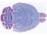 Brain of mouse  horizontal l.s. of the complete organ