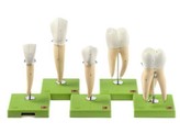 FIVE MODELS OF TEETH