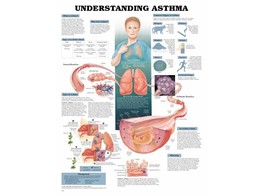 UNDERSTANDING ASTHMA POSTER