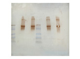 DETECTING RISK FACTORS FOR ALZHEIMER S DISEASE USING WESTERN BLOT