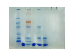 AIDS KIT III  SIMULATION OF HIV DETECTION BY PROTEIN ELECTROPHORESIS