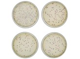 TRANSFORMATION DE E.COLI AVEC DES PROTEINES COLOREES