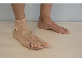 PORTABLE DIABETIC FOOT