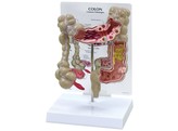 COLON MODEL - W33364