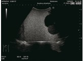 SIMULATEUR DE FORMATION A LA MESURE DU VOLUME INTRAVESICAL DE L URINE