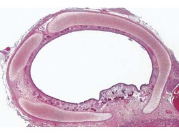 Trachea of cat or rabbit  t.s. with ciliated epithelium  cartilage etc.