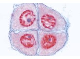Lilium  Antheren quer. Pollenmutterzellen  Tetradenbildung nach vollendeter zweiter Teilung