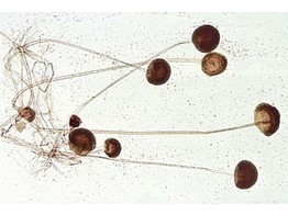 Mucor mucedo  black mold  sporangia and mycelium w.m.