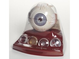 CATARACT EYE MODEL