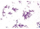 Proteus vulgaris  bacteries de la putrefaction  frottis