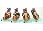 SERIES OF MODELS REPRESENTING CONGENITAL ORGANIC HEART DEFECTS