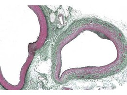 Arterie und Vene des Menschen  quer  Elastica-Farbung