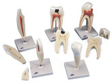 CLASSIC TOOTH MODEL SERIES  5 MODELS   D10  1017588 