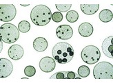 VOLVOX SP. MET DOCHTERKOLONIEN