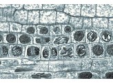 Mitoses a differents stades  extremite d une racine d Allium  c.l. Tous les stades dans la meme preparation. Coloration hematoxyline ferrique