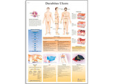 DECUBITUS ULCERS CHART