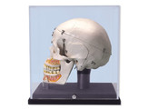 DELUXE HUMAN DEMONSTRATION DENTAL SKULL MODEL  10 PART  WITH DISPLAY CASE -  A27/9  1000060 