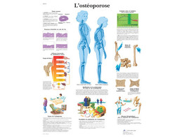 POSTER  L OSTEOPOROSE -  FRANCAIS - VR2121L