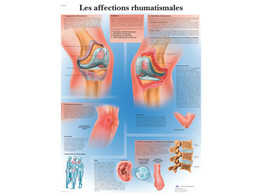 POSTER   LES AFFECTIONS RHUMATISMALES - VR2124L