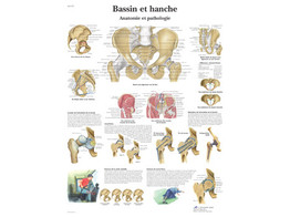 POSTER  BASSIN ET HANCHE - ANATOMIE ET PATHOLOGIE - VR2172L