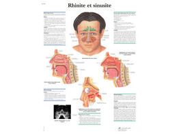 POSTER RHINITE ET SINUSITE - VR2251L