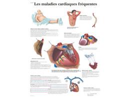 POSTER LES MALADIES CARDIAQUES FREQUENTES -VR2343L