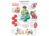 POSTER L HYPERTENSION - VR2361L