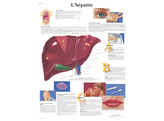 POSTER L HEPATITE - VR2435L