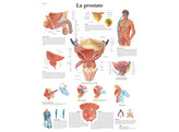 POSTER LA PROSTATE - VR2528L