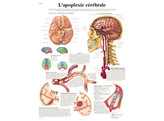 POSTER  L APOPLEXIE CEREBRALE - VR2627L