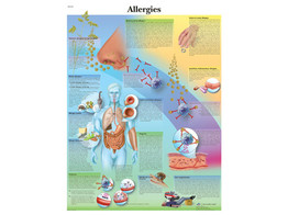 POSTER ALLERGIES - VR2660L