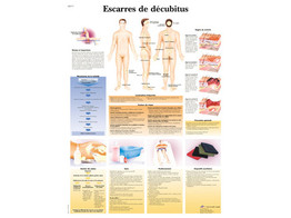 POSTER ESCARRES DE DECUBITUS - FRANCAIS - VR2717L